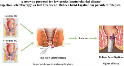A Stepwise Proposal for Low-Grade Hemorrhoidal Disease: Injection Sclerotherapy as a First-Line Treatment and Rubber Band Ligation for Persistent Relapses